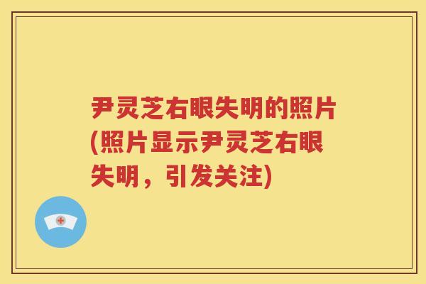 尹灵芝右眼失明的照片(照片显示尹灵芝右眼失明，引发关注)